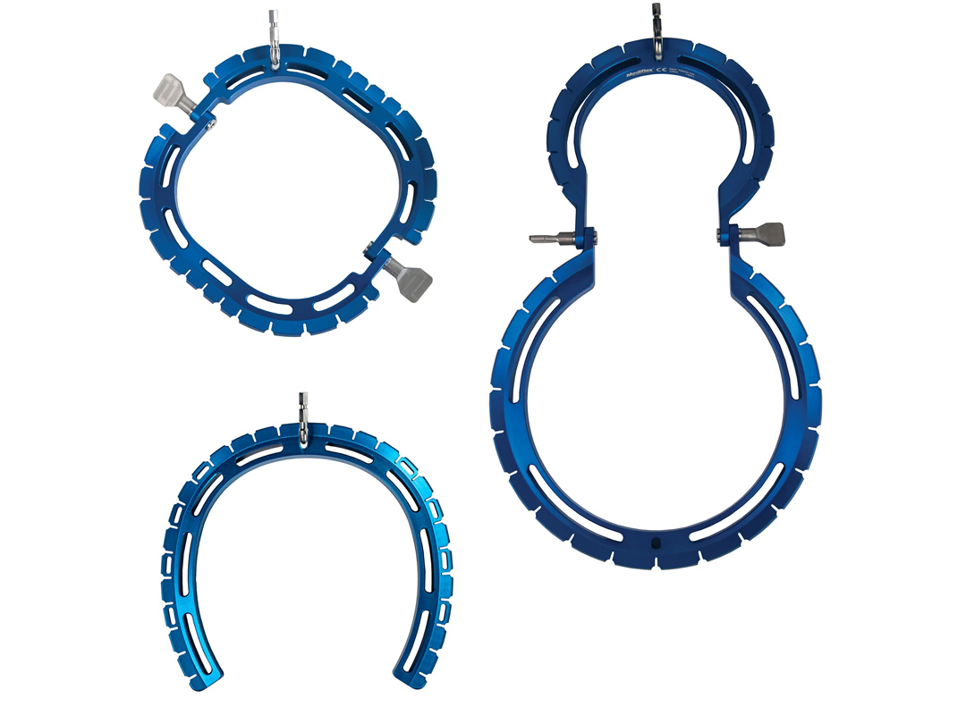 DynaTrac Retractor System | Table Mounted Retractor Systems | Mediflex ...