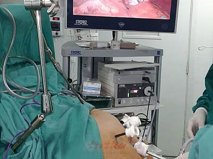 Nathanson Liver Retractor Systems | Tutku Sağlık