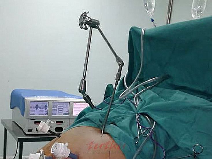 Nathanson Liver Retractor Systems | Tutku Sağlık