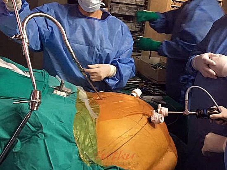Nathanson Liver Retractor Systems | Tutku Sağlık
