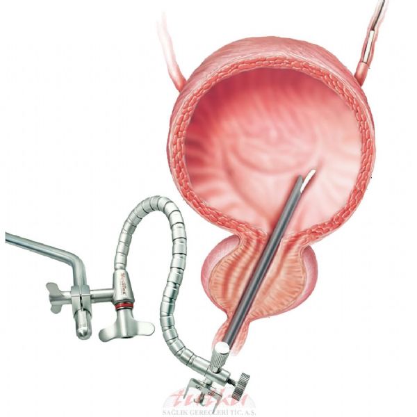 CystoAssist FlexArm Mini Tutma Ucuyla (Sadece FlexArm ve Uç) | Tutku Sağlık