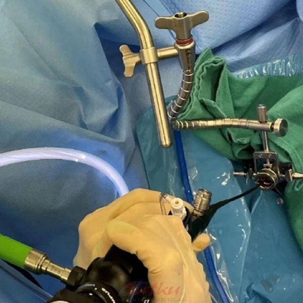 CystoAssist Sistemleri | Tutku Sağlık