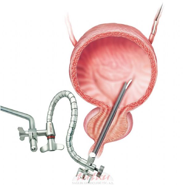 CystoAssist Tutma İpuçları | Mediflex | Tutku Sağlık