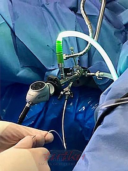 Physicians are able to work with both hands, without an assistant