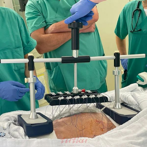 Fasciotens Abdomen | Tutku Sağlık