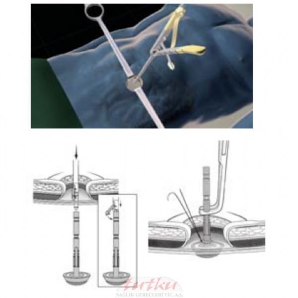 Frankenman Örs Kavrama Forceps | Tutku Sağlık