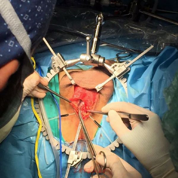 Mini-Bookler URO/GYN Basic Surgery System | Mediflex | Tutku Sağlık